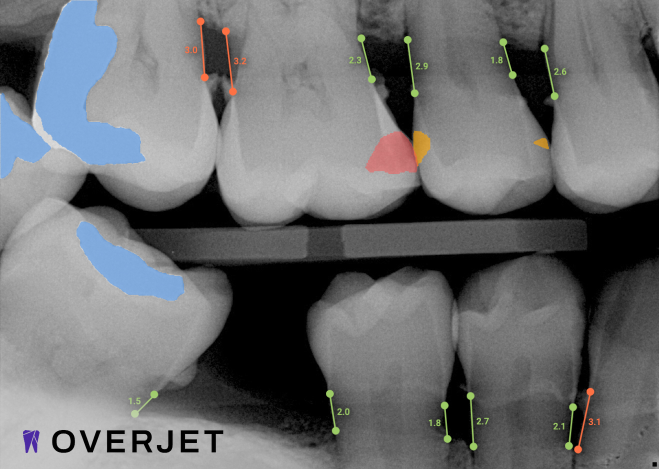 Quality Dental Services | Complete Dental Care